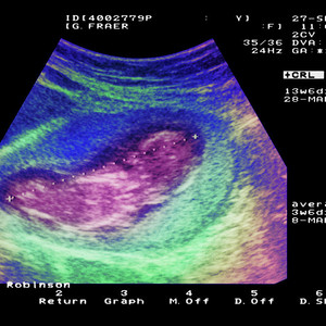 Ultrasound in panipat
