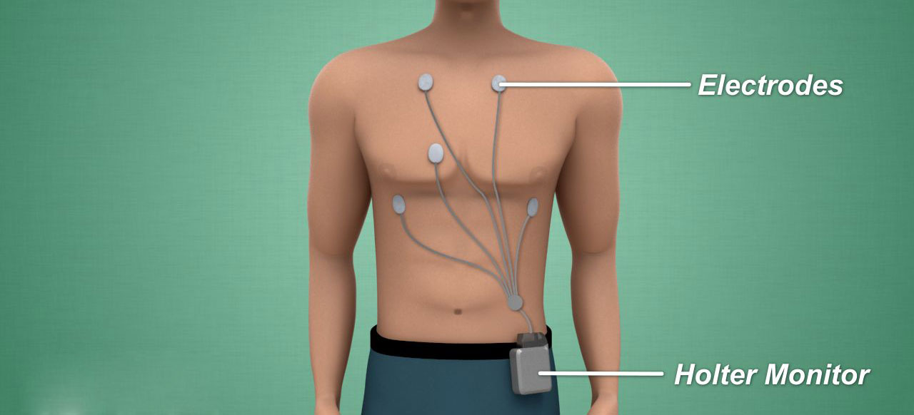Holter Monitor in Panipat